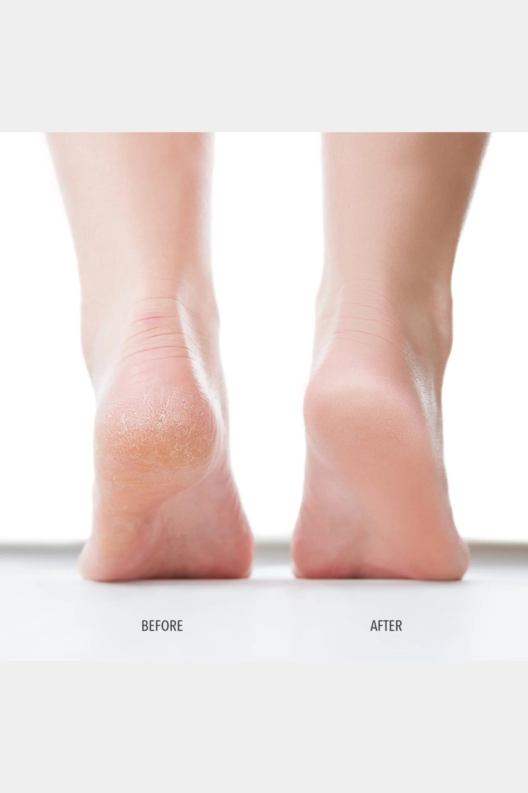 Londontown Foot Scrub 7 Londontown Foot Scrub - Image 5